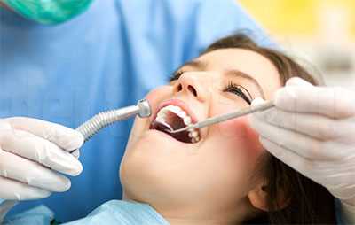 Профессиональная чистка зубов - оптимальное решение перед удалением или протезированием