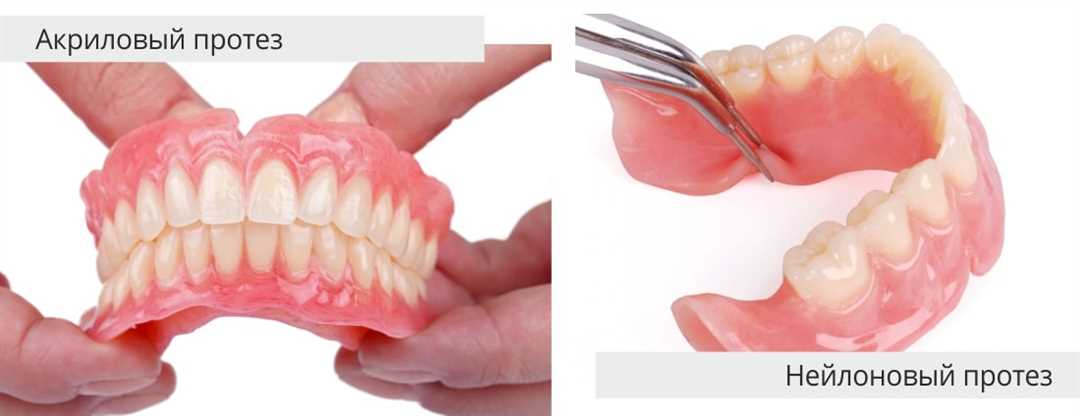 Полный съемный зубной протез
