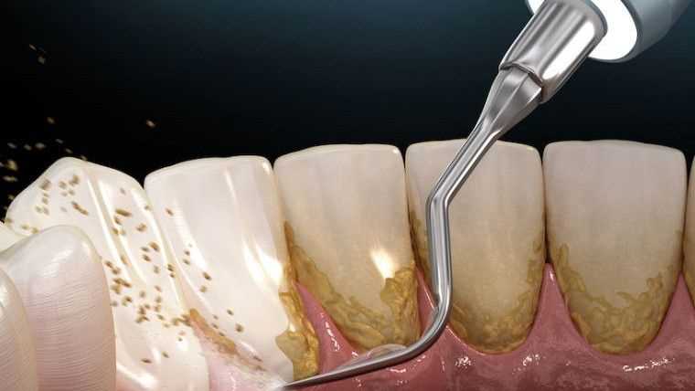Особенности проведения анестезии в стоматологической практике