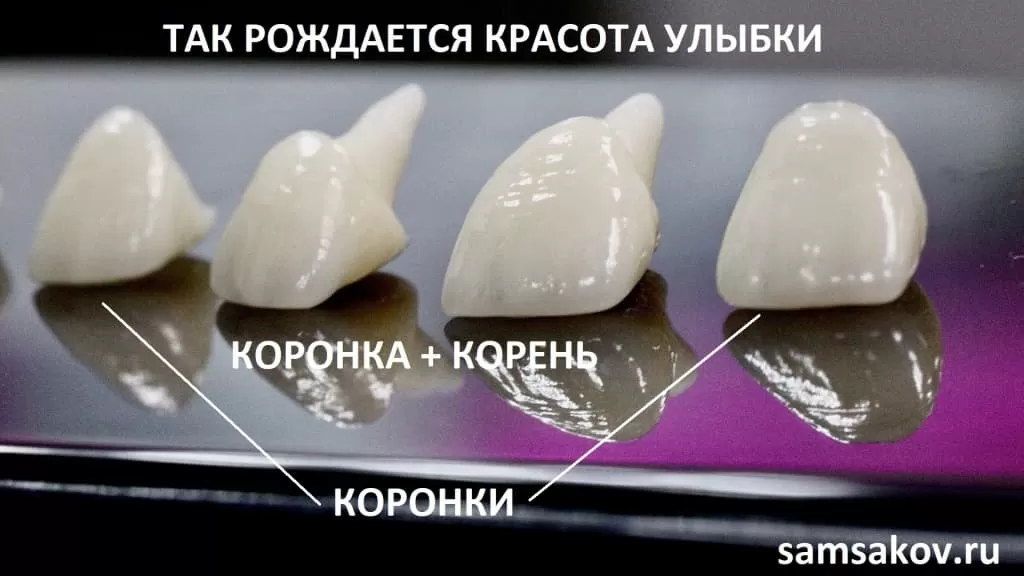 Поверхности зубной коронки