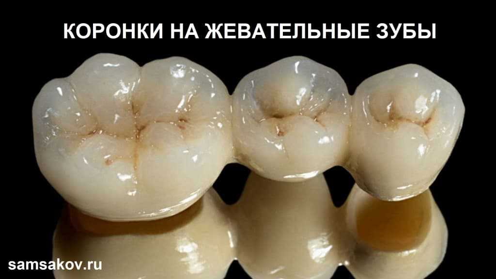 Виды поверхностей зубной коронки — анатомическая, окклюзионная, мезиальная, дистальная, фасеточная и инклинационная