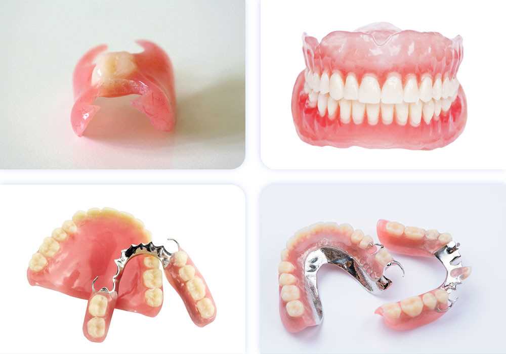Особенности повторного протезирования при полной потере зубов