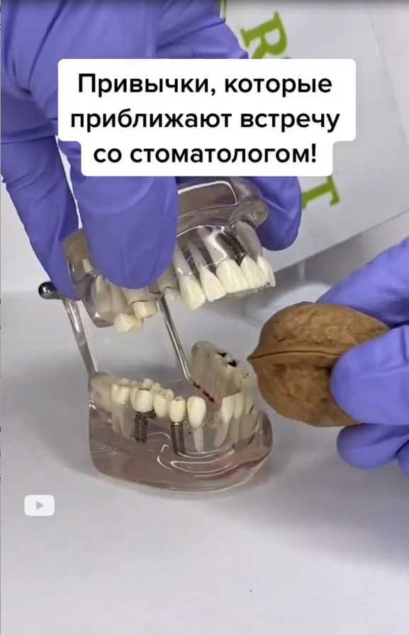 В Санкт-Петербурге пятилетняя девочка на приеме у стоматолога проглотила насадку от бормашины