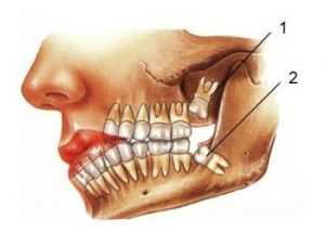 Причины удаления зуба