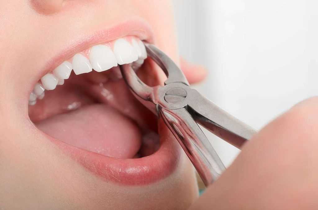 Причины удаления зуба
