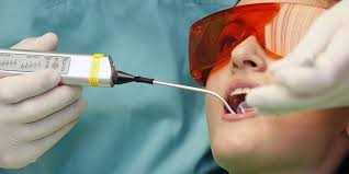 Прижигание десны при лечении зубов