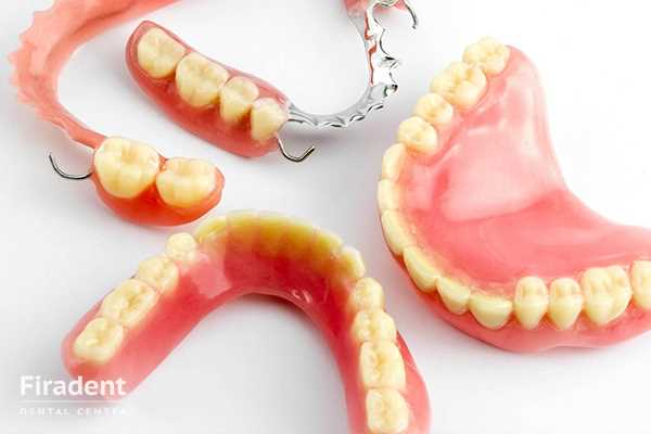 Протезирование зубов виды протезов