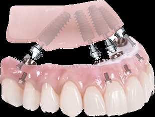 Виды зубных протезов по материалу изготовления