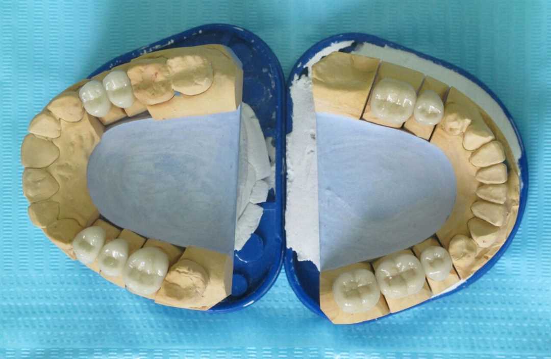 Протезирование зубов 4 поликлиника