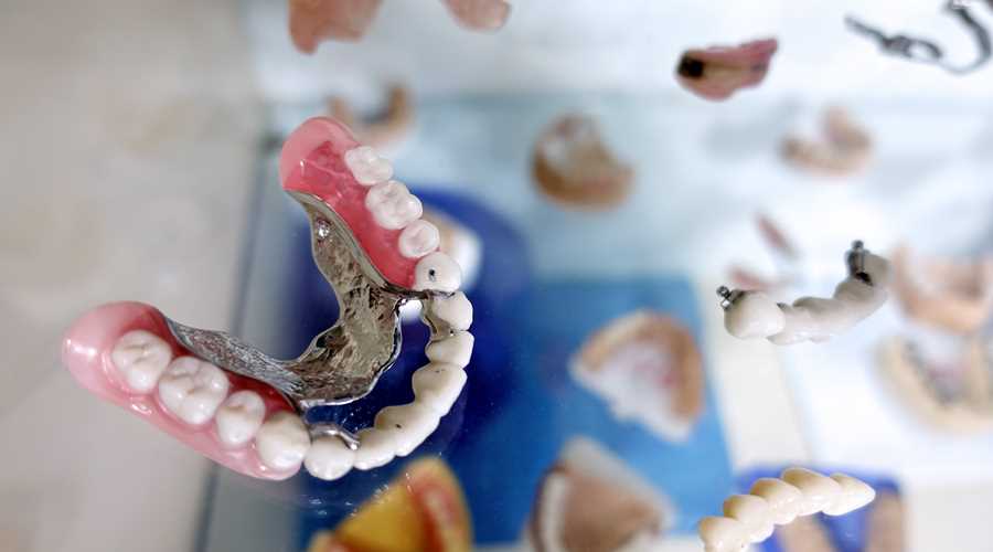 Протезирование зубов – инновационное решение для улучшения качества жизни пенсионеров