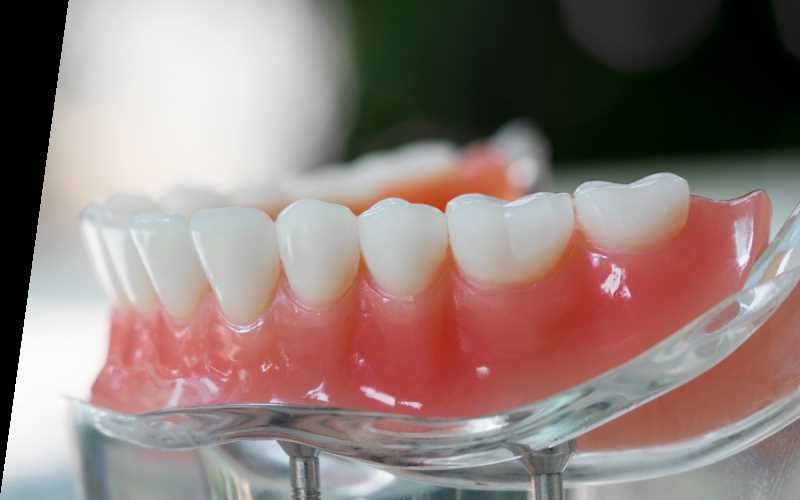 Как выбрать лучшего доктора для протезирования зубов и восстановить улыбку без проблем и стресса?