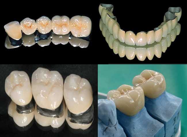 Протезирование зубов в Доне — надежное восстановление улыбки и здоровья