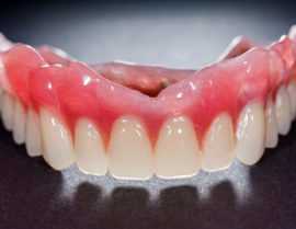 Протезирование зубов инвалидам 2