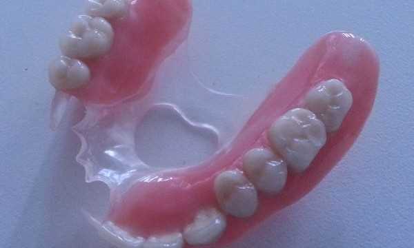 Протезирование зубов квадротти