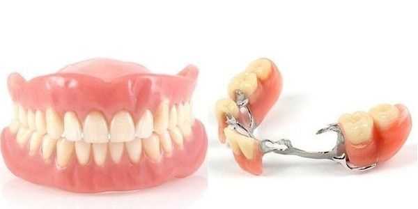 Современные методы протезирования зубов — эффективные решения для восстановления здоровья и красоты