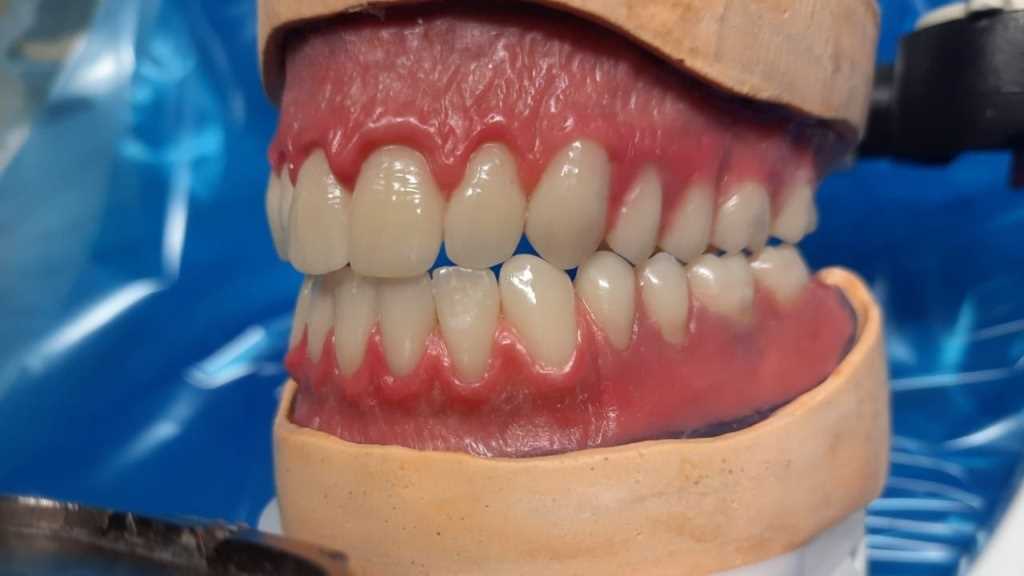 Как долго длится консультация и лечение зубов на дому?