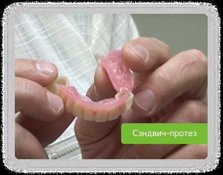 Протезирование зубов отсутствие верхних зубов