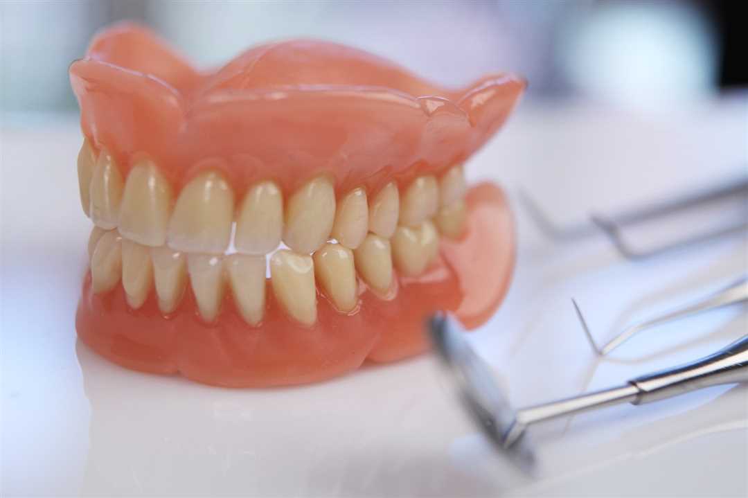 Какой протез выбрать при отсутствии всех зубов