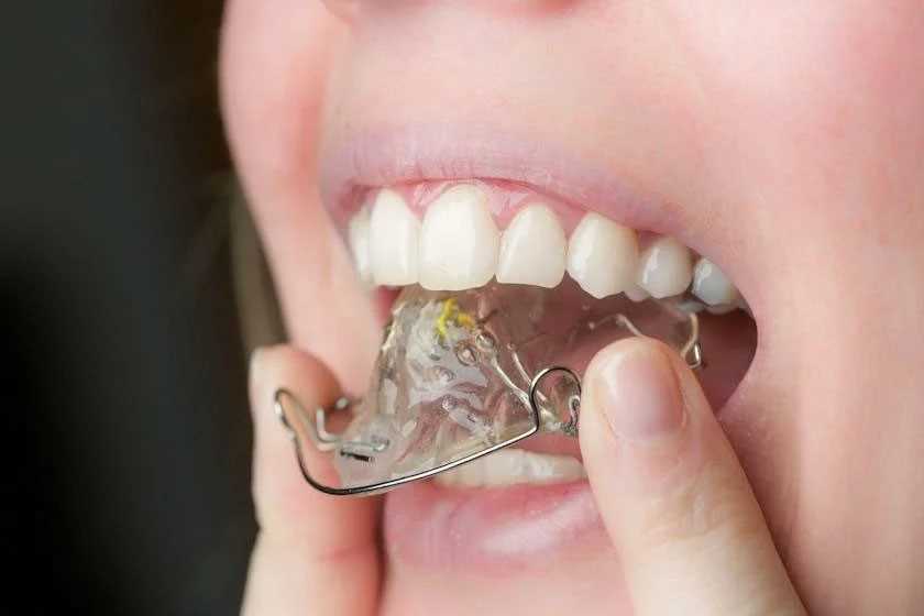Протезирование зубов пластина