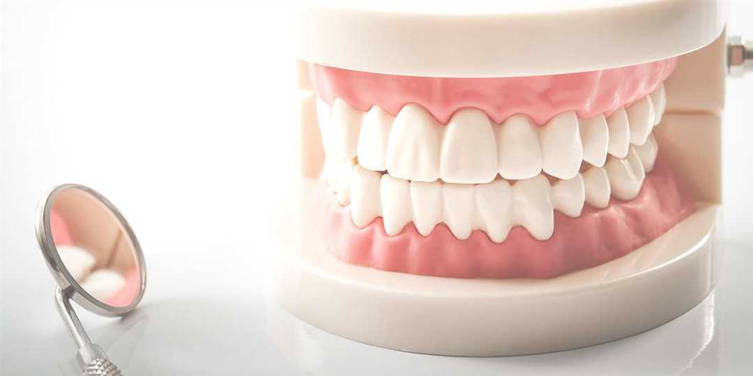 Виды частичного зубного протезирования