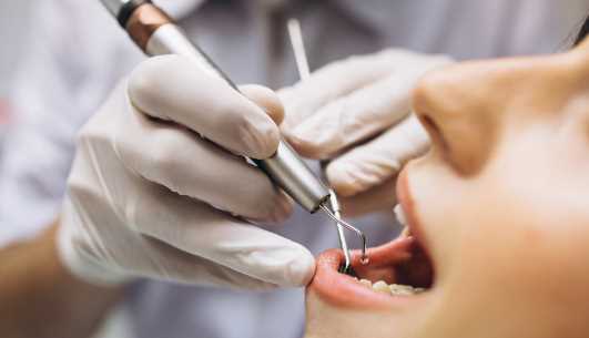 Как получить квоту на протезирование зубов по ОМС?