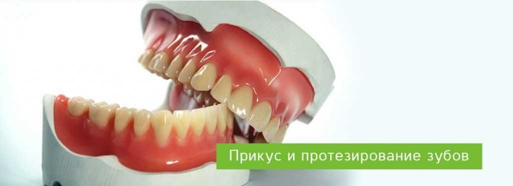 Протезирование зубов прикус