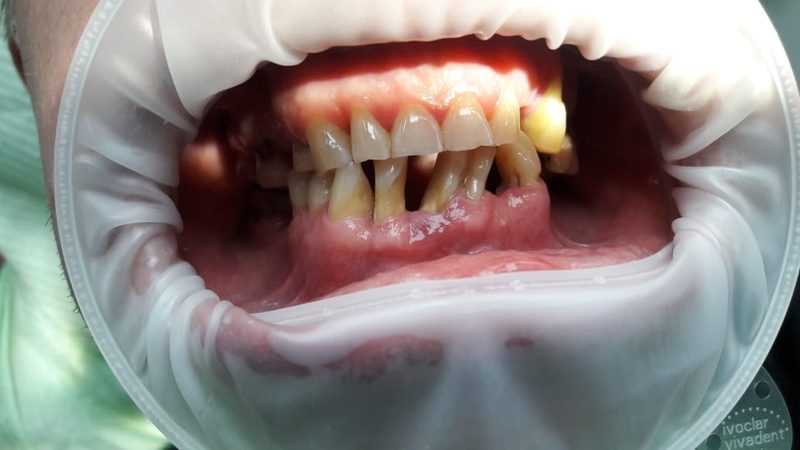 Важная роль зуботехнической лаборатории в процессе протезирования