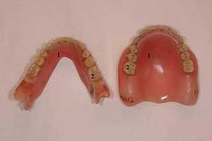 Каким категориям военнослужащих положено льготное протезирование зубов?