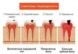 Протокол лечения пульпита — эффективные методы диагностики, лечения и профилактики заболевания для сохранения здоровья зубов