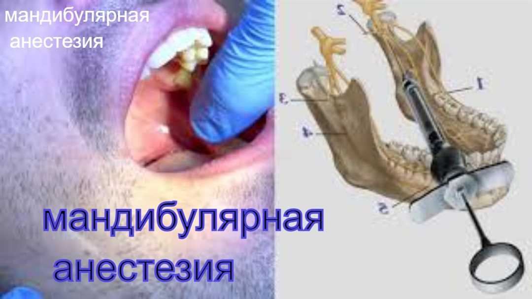 Проводников анестезия зуба