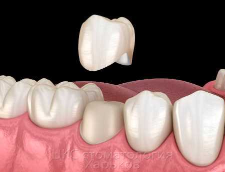 Различие величины зубов в норме и патологии
