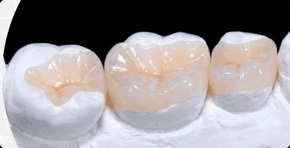 Этапы восстановления зуба вкладкой