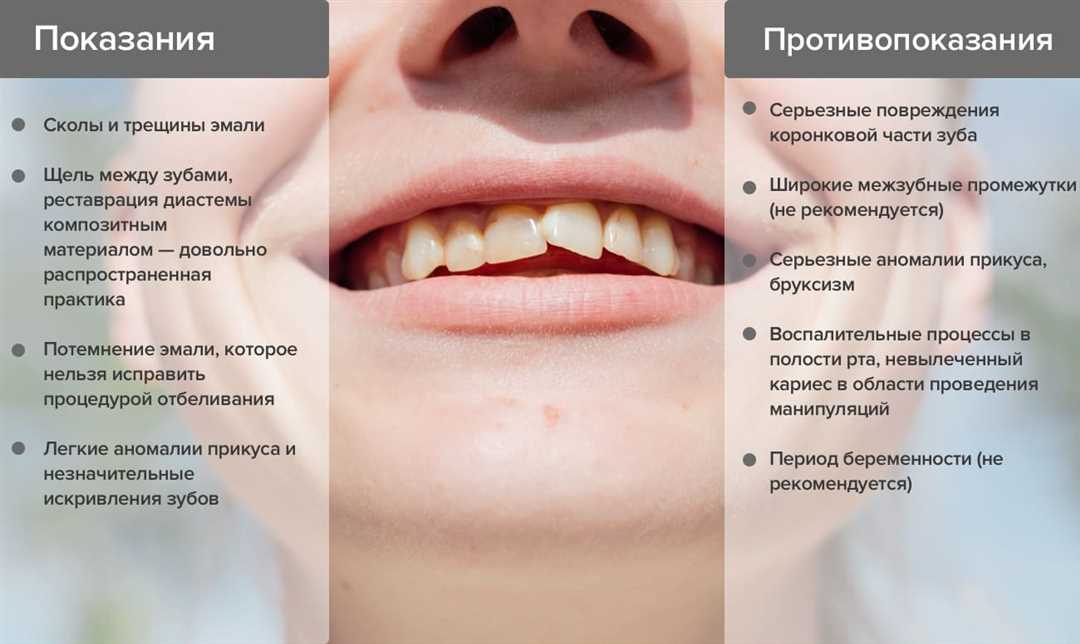 Реставрация зубов - преимущества и недостатки процедуры