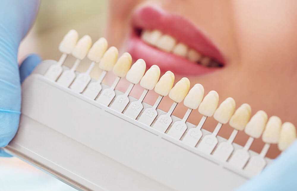 Реставрация зубов дантистофф