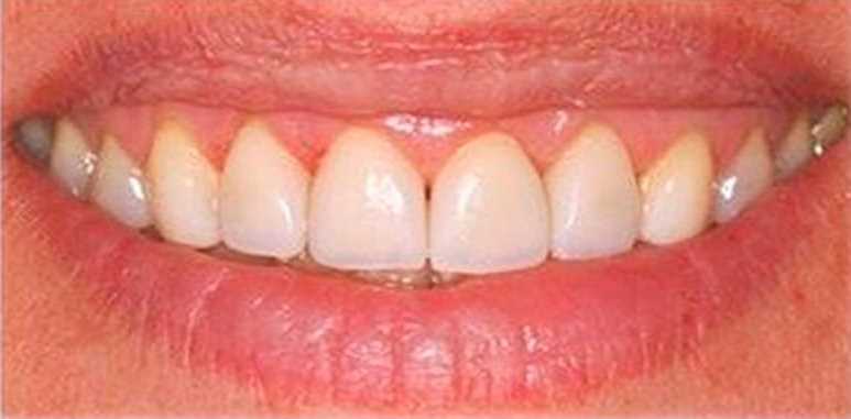 Восстановление зубов в Доне — современные технологии и лучшие специалисты