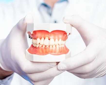 Семейное протезирование зубов — решение проблем с зубами для всей семьи