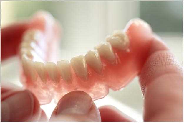 Съемные протезы зубов: определение и виды
