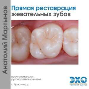 Щербаков реставрация зубов