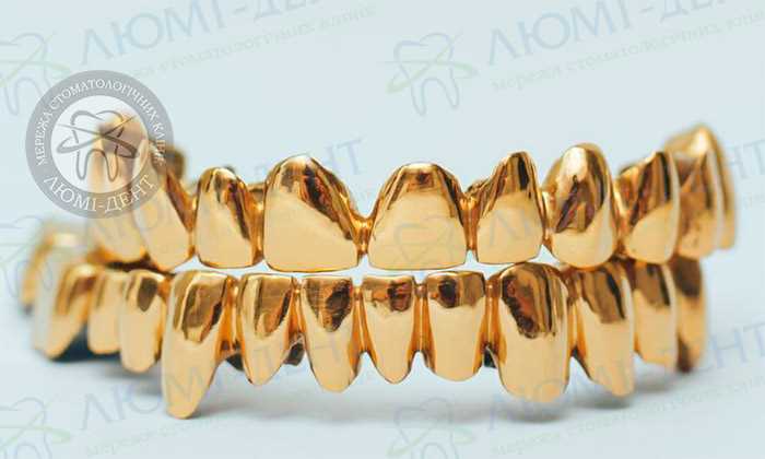 Показания к установке золотых зубов