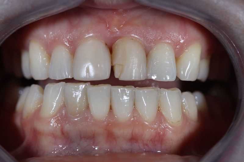 Реконструктивная стоматология