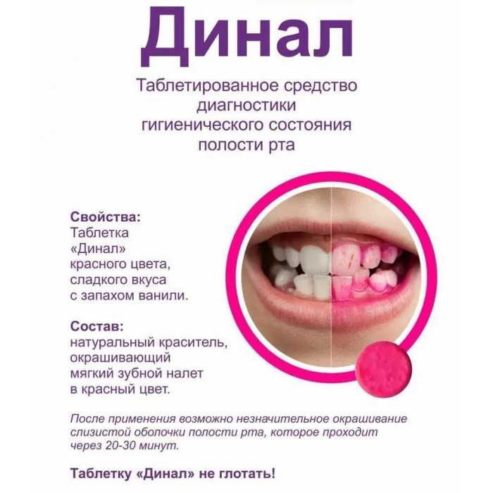 Зубной налет. Причины и механизмы