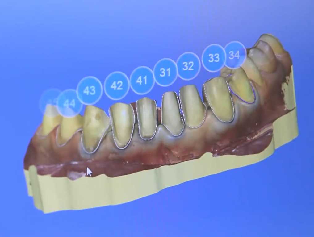 Современные технологии реставрации зубов