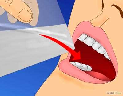 Можно ли полоскать рот после удаления зуба?