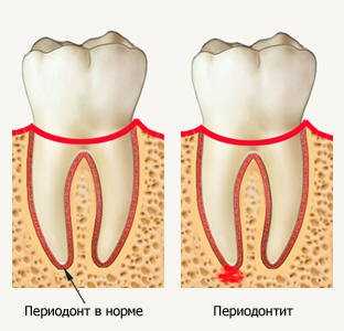 Важность диагностики зубов при травмах