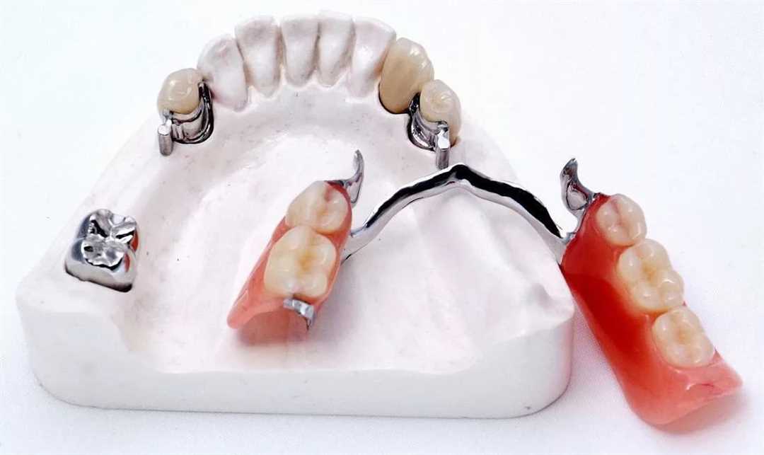 Цифровое протезирование зубов
