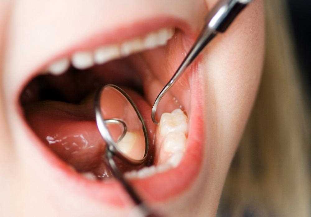 Удаление семерки зуб