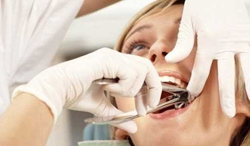 Показания для удаления гнилого зуба и возможные осложнения