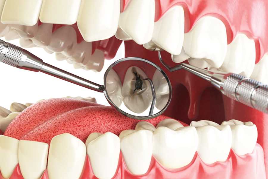 Бережное удаление зубов