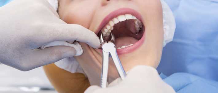 Удаление заложенного зуба