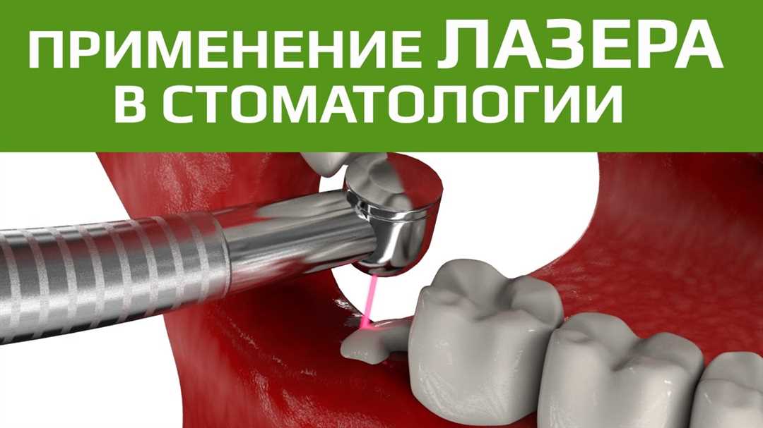 Как проходит удаление зубов мудрости в Москве